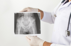 Lege holder røntgen IS-ledd hos AS-pasient