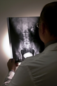 Lege ser på røntgenbilder av hofte og korsrygg