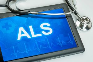 Bokstavene ALS skrevet på et nettbrett med et stetoskop oppå