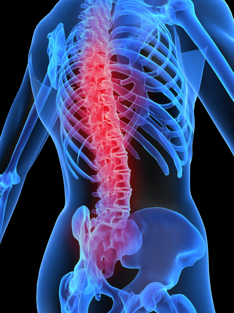 Illustrasjon av blåaktig skjelett med rødmarkert ryggrad og bekken der det er smerter ved aksial spondyloartritt