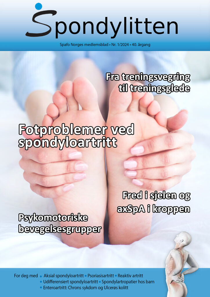 Forsiden på Spondylitten 1-24 med tema fotplager