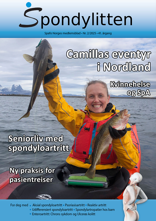 Foprsiden på medlemsbladet Spondylitten 2-25 med en kvinne i kajakk som holder opp to torsk