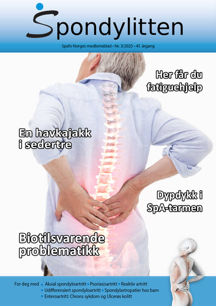 Forsiden av medlemsbladet Spondylitten 3-25 med bilde av ryggen til en eldre mann, som holder seg i korsryggen, og man ser tegning av smertefull ryggrad gjennom den hvite skjorta
