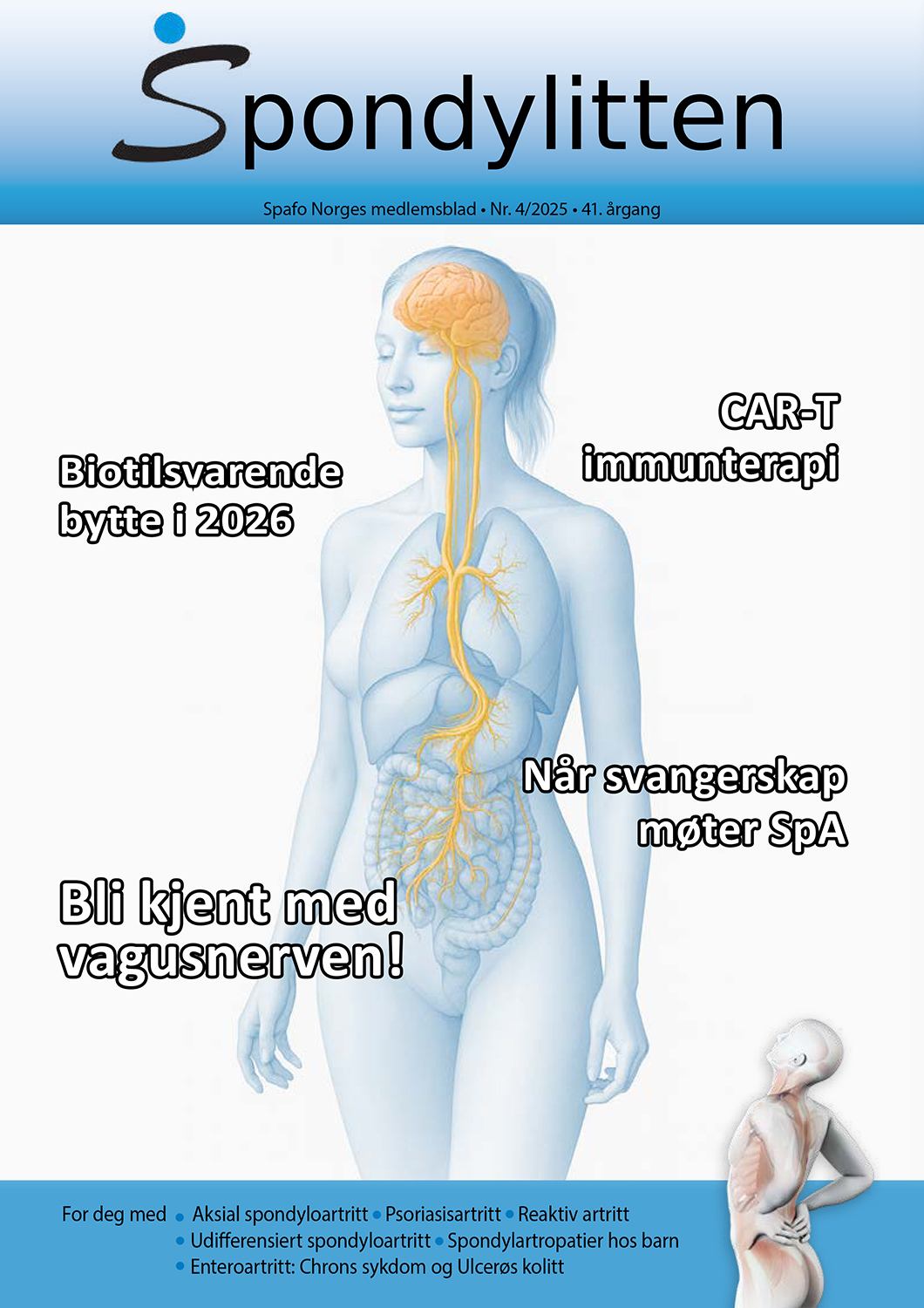 Bilde av forsiden til Spondylitten 4-25, med illustrasjon av kvinne i blåtoner med oransjemarkert vagusnerve