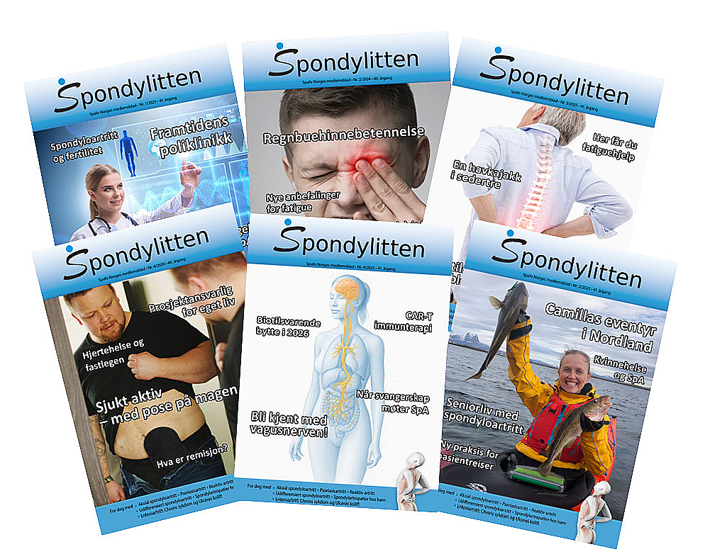 Vifte med de seks siste forsiden av medlemsbladet Spondylitten