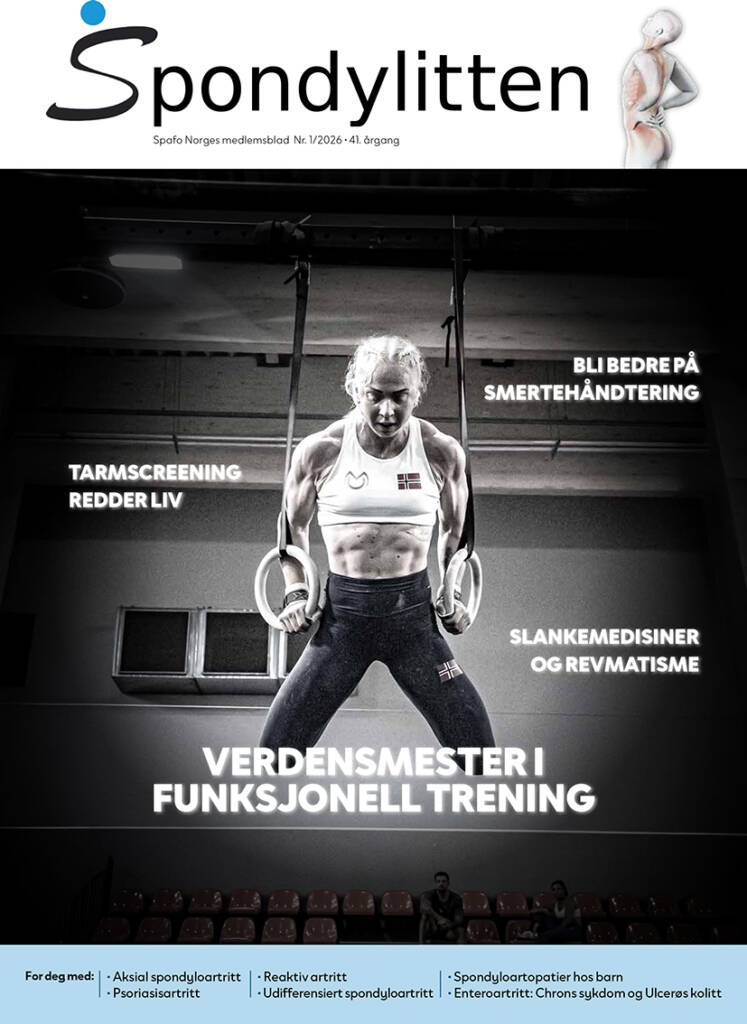 Forsiden Spondylitten 1-26, med Stine Moen Nilsen under en styrkeøvelse i turnringer som forsidebilde