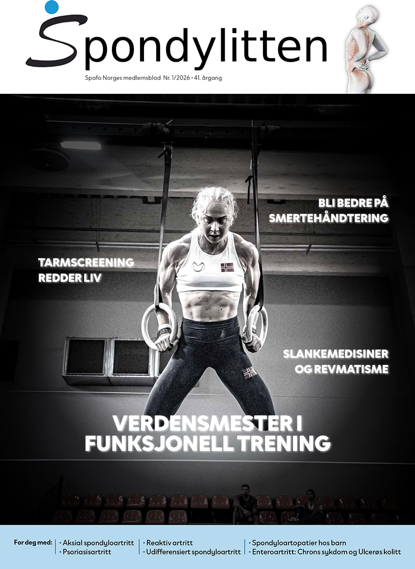 Forsiden Spondylitten 1-26, med Stine Moen Nilsen under en styrkeøvelse i turnringer som forsidebilde