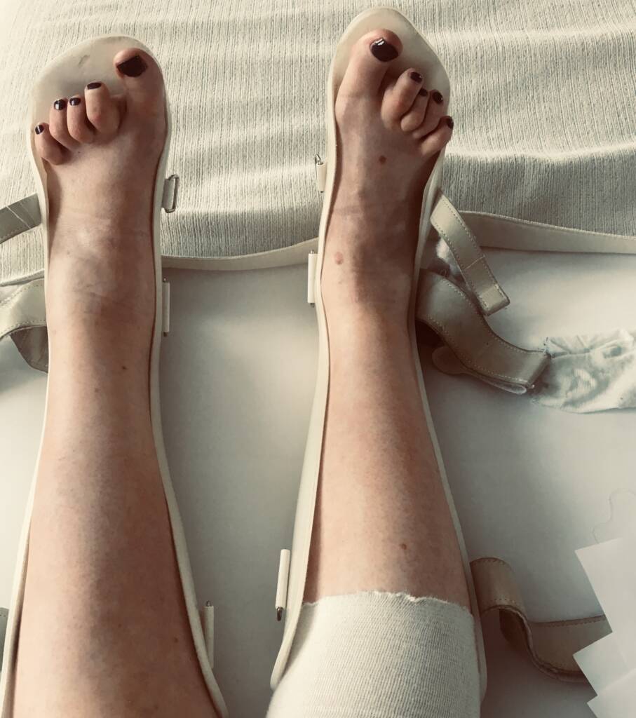 Føtter som ligger i hvite hvileskinner på sengen