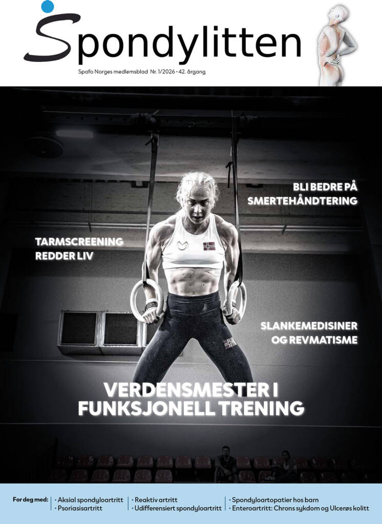 Forsiden Spondylitten 1-26, med Stine Moen Nilsen under en styrkeøvelse i turnringer som forsidebilde