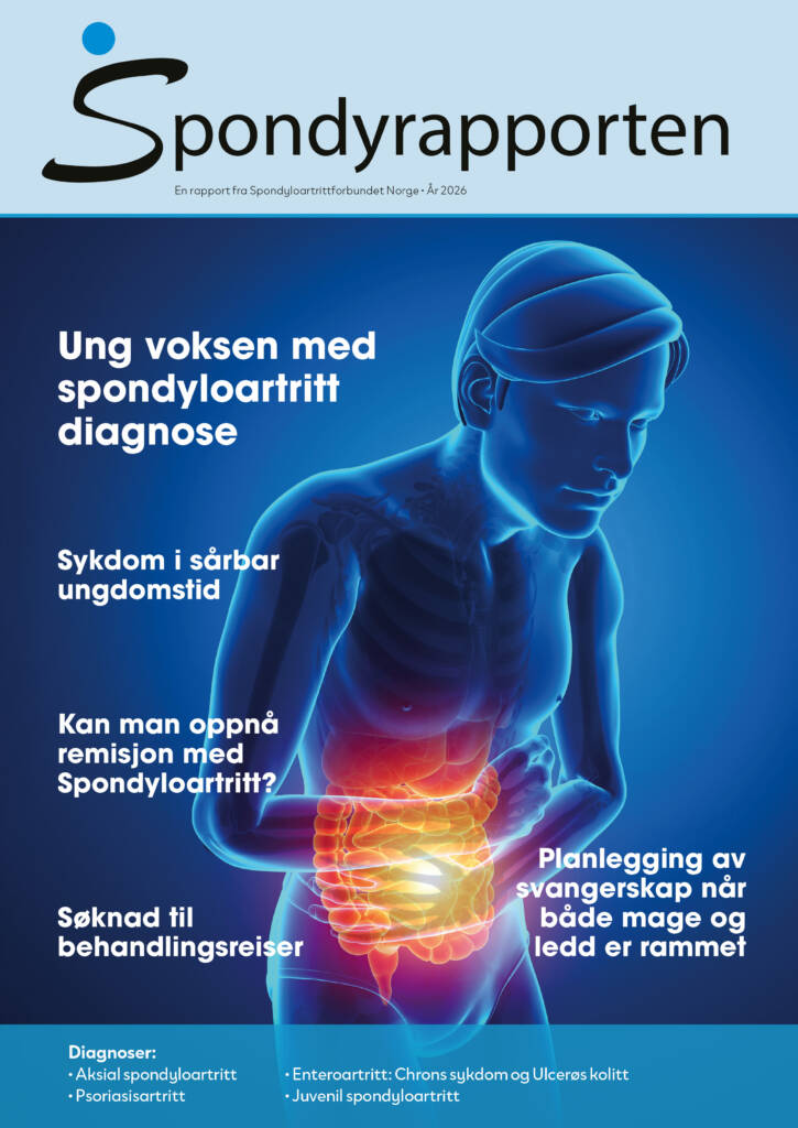 Forside Spondyrapporten 2026 med illustrasjon ung mann med smerter i magen