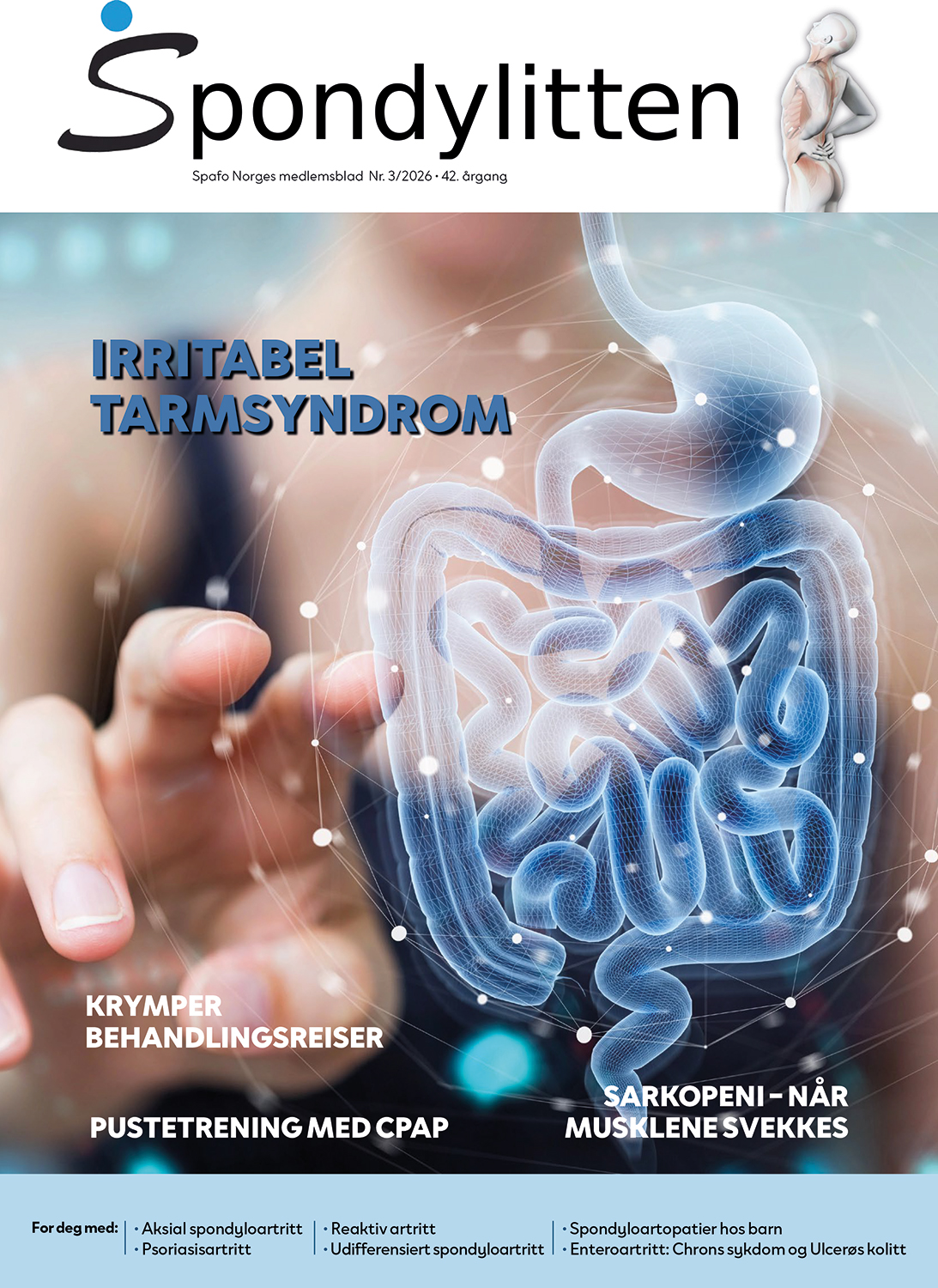 Forsiden til Spondylitten 3-26 med hovedtemaet irritabel tarmsyndrom (IBS). Bilde av kvinnehånd som trykker på en digital tarm på en skjerm